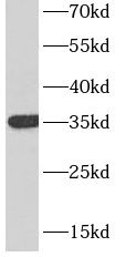 CD7 antibody