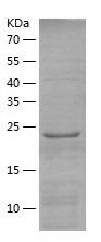 Recombinant Human BEND6