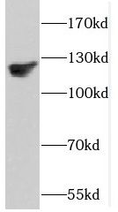 DAAM1 antibody