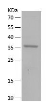 Recombinant Human PIH1D1
