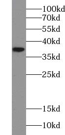 UBLCP1 antibody