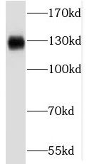 RBM6 antibody