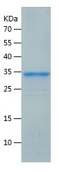 Recombinant Human SNAI2