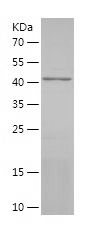 Recombinant Human ADAM12