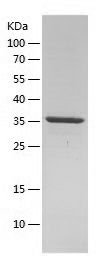 Recombinant Human NF1