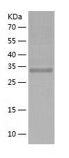 Recombinant Human RPRD1A