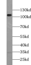 LAMP1 antibody