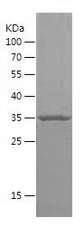 Recombinant Human DHH