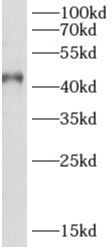 AIPL1 antibody