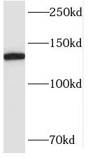 SMC6 antibody