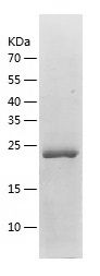 Recombinant Human CBR4