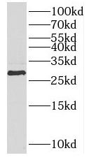 PPT2 antibody