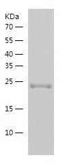 Recombinant Human MBD4