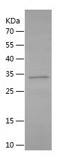 Recombinant Human CD21