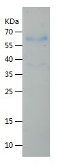 Recombinant Human tPA beta chain