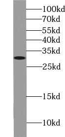 ZWINT antibody