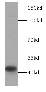 HLA-C antibody