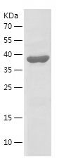 Recombinant Human NUSAP1