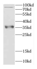 CCS antibody