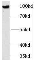 TMTC1 antibody