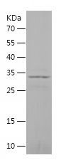 Recombinant Human IDE