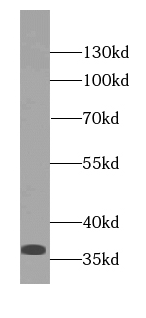 RPRD1A antibody