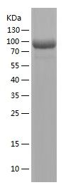 Recombinant Human IL-12RB1