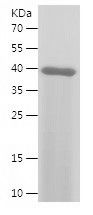 Recombinant Human COQ7
