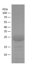 Recombinant Human PPP2R2A