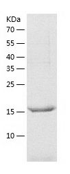 Recombinant Human JOSD1