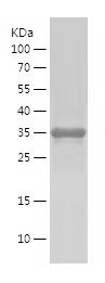 Recombinant Human PLAU
