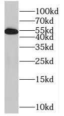 SPATS2L antibody