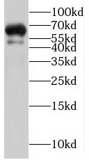PTPN5 antibody