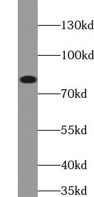 ABCD1 antibody