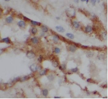 VIPR1 antibody