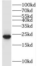 TRAPPC1 antibody