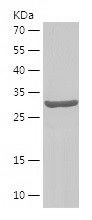 Recombinant Human DNAJB12