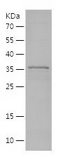 Recombinant Human S100A16