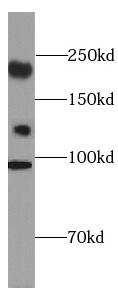 CC2D2A antibody