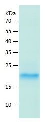 Recombinant Human LAIR2