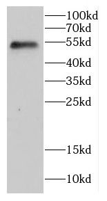 CCT2 antibody