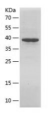 Recombinant Human TTN