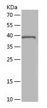 Recombinant Human ACADM