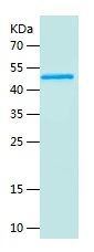 Recombinant Human ANGPTL7