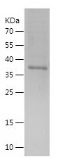 Recombinant Human DDX1