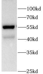 Phospho-Smad3(S423/S425) antibody