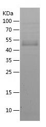 Recombinant Human ZEB1
