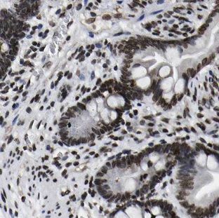 TMEM8B antibody