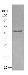 Recombinant Human ARRB1