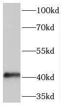 SERPINB5 antibody